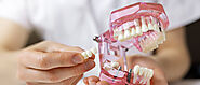 A Complete Guide to Dental Bridges