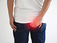Piles Treatment - How Many Ways We can Cure Piles or Hemorrhoids?