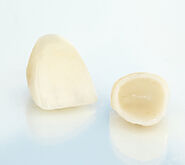 Dental Crowns Near You