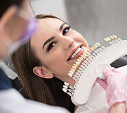 Porcelain Veneers in Kitchener
