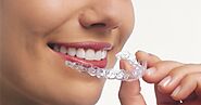 Exploring the Stages of Invisalign Treatment