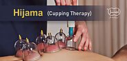 Hijama Therapy - How to Treat with Hijama