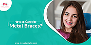 What Are The Ways To Care For Metal Braces?