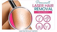 Tips to Get Prepared for First Time Laser Hair Removal