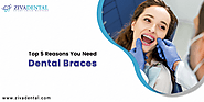 Why Do You Need Dental Braces?