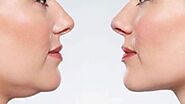 Jaw Fat: 9 Effective Ways to Reduce Double Chin | FASHION DRIPS