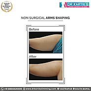 Get Non Surgical Arms Shaping Treatment