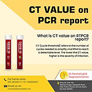 CT value on your RT-PCR reports - Dr. Panchal Lab, Diagnostic Centre in Borivali