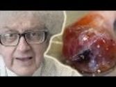 Chicken in Acid Conclusion - Periodic Table of Videos