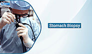 Understanding Stomach Biopsy: Procedure, Risks, and Complications