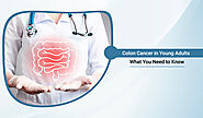 Colon Cancer in Young Adults: What You Need to Know