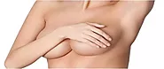 Breast Reduction Surgery in Lucknow | Recovery, Cost & Safety
