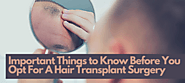Important Things to Know Before You Opt For Hair Transplant Surgery