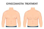 Gynecomastia Surgery: Everything You Need To Know Before Opting Gynecomastia Surgery