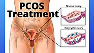 PCOS Treatment: Everything You Need To Know