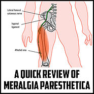 Meralgia Paresthetica: Symptoms, Treatment, And Diagnosis