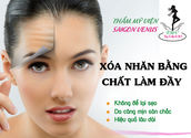 Xóa nhăn bằng chất làm đầy