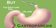 Guest Post: Gastroparesis Another "But You Don't Look Sick" Disease