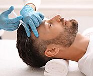 FUE Hair Transplant for Norwood Pattern Baldness