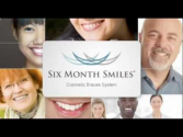 Clear Braces for Adults - General and Cosmetic Dentist