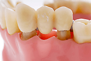 Best Dental Clinic in Trichy Road, Coimbatore |Top 10 Dental Clinic