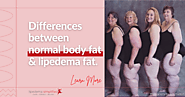 Why Lipedema Fat is Different?