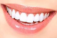 Can dental implants be whitened