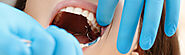 Wisdom Tooth Extraction in Dubai, Abu Dhabi & Sharjah | Tooth Extraction Cost