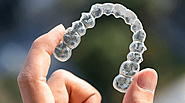 10 Things to Know Before Starting an Invisalign Treatment