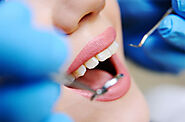Dental Treatment in Gurgaon - Root Canal Treatment - Dentist