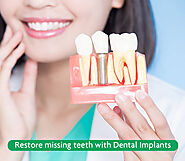 Dental Treatment in Gurgaon - Root Canal Treatment - Dentist