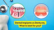 Dental Implants vs. Dentures: What is Best for You? | Teethcare