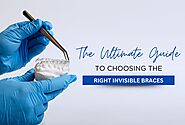 The Ultimate Guide to choosing the right invisible braces | Teethcare