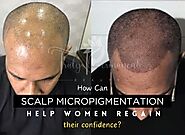 How can scalp micropigmentation help women regain their confidence?