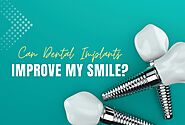 Can Dental Implants Improve My Smile? | Teethcare