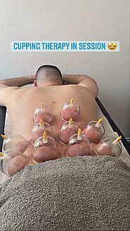 Cupping Therapy in Bromley