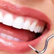 Dental Clinic Baner | Best Dentist in Baner | Dental Specialist in Baner