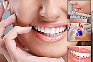 Cosmetic Dentistry in Baner, Best Cosmetic Dental Treatment Fees Baner
