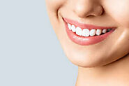 Teeth Whitening Treatment in Baner, Teeth Bleaching Cost in Baner
