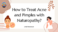 How to Treat Acne and Pimples with Naturopathy | edocr