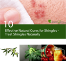 10 Effective Natural Cures for Shingles - Treat Shingles Naturally