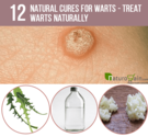 12 Natural Cures for Warts - Treat Warts Naturally