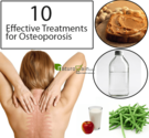 Natural Osteoporosis Treatment - 10 Effective Treatments for Osteoporosis