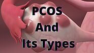 PCOS And Its Types: A Complete Comprehensive Guide