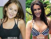 See the Change of Angelique Boyer Before and After Nose Job Surgery