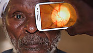 Have you got cataracts in your eyes? Find out here