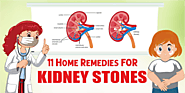11 Home Remedies For Kidney Stones | Shuddhi Ayurveda