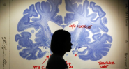 Toward the Treatment of Alzheimer's With Electrical Shocks to the Brain - Atlantic Mobile