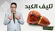 تليف الكبد # الدكتور أحمد أبو النصر