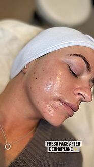 What Is Dermaplaning? Benefits of Women Shaving Face - Renuvenate